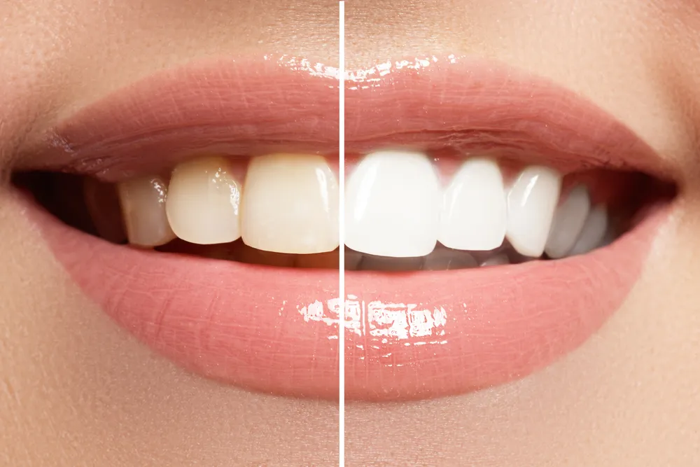 Estetica dentale